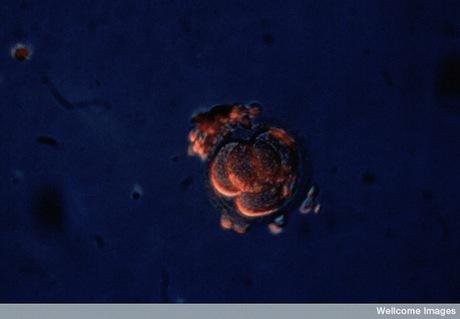 Four-cell human embryo. Wellcome Images. All rights reserved.