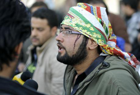 Wounded man talks to media after suicide attack hits a procession of Shiite mourners in Kabul City, 2013.