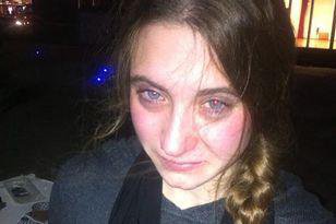AshDoyle14-image-taken-after-pepper-spray-used-on-protesters.jpg