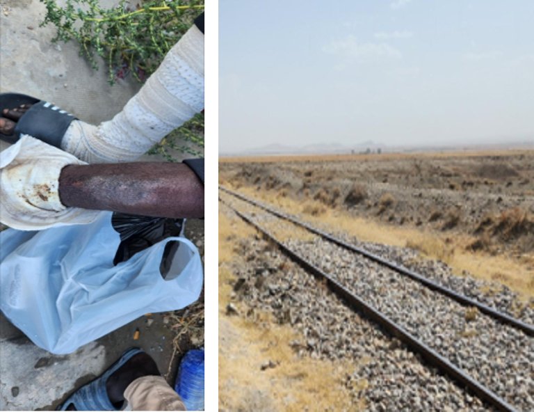 Image on the left: a man's bandaged leg showing bruises; image on the right: a train track in a deserted area