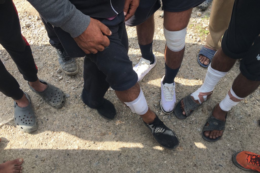 Pakistani migrants show injurie by Croatian border police, September 2019.