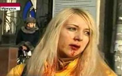 Anna Shavenkova, daughter of an important regional official, escaped the accident with minor injuries.